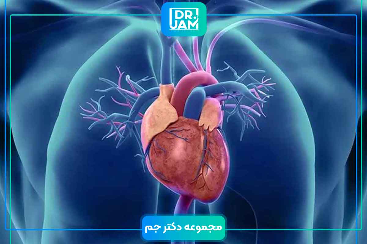 Cardiomyopathy problem