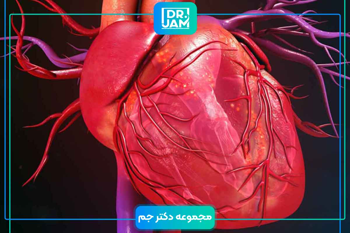Heart cardiomyopathy