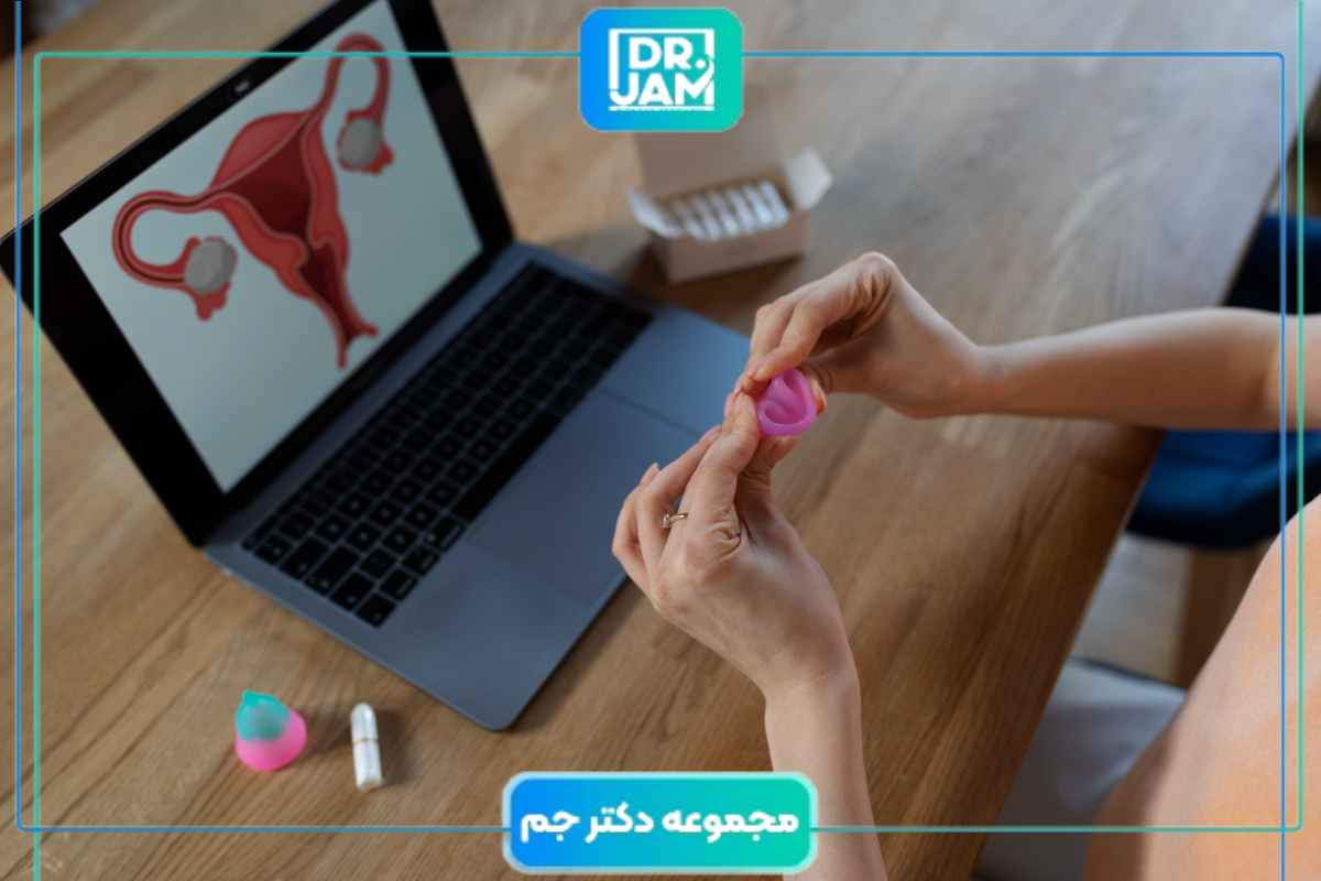 کاپ قاعدگی چیست