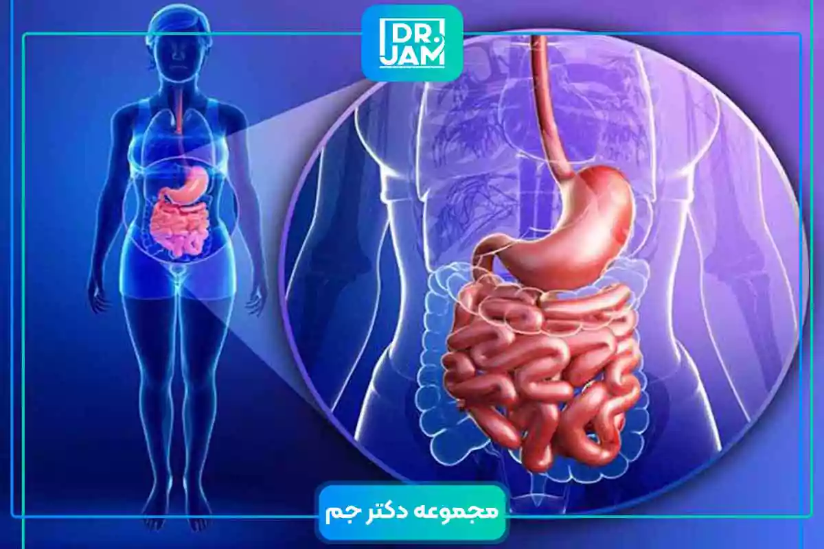 What is Crohn's disease?