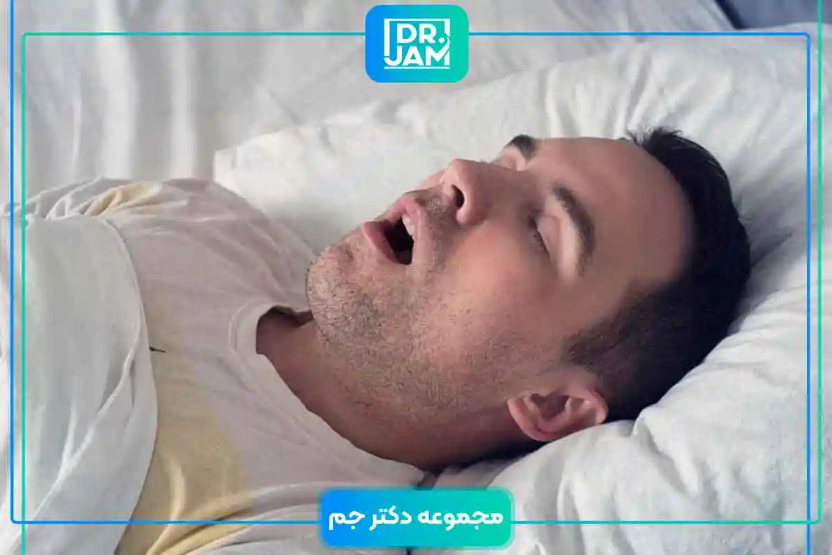 Sleep Apnea