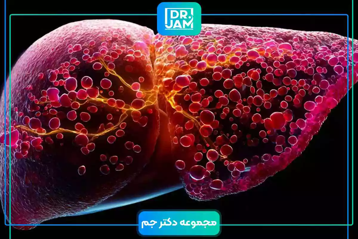 The relation between NAFLD and psoriasis