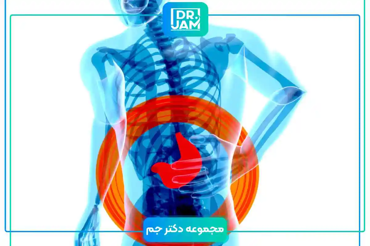 Fatty liver disease grade 3