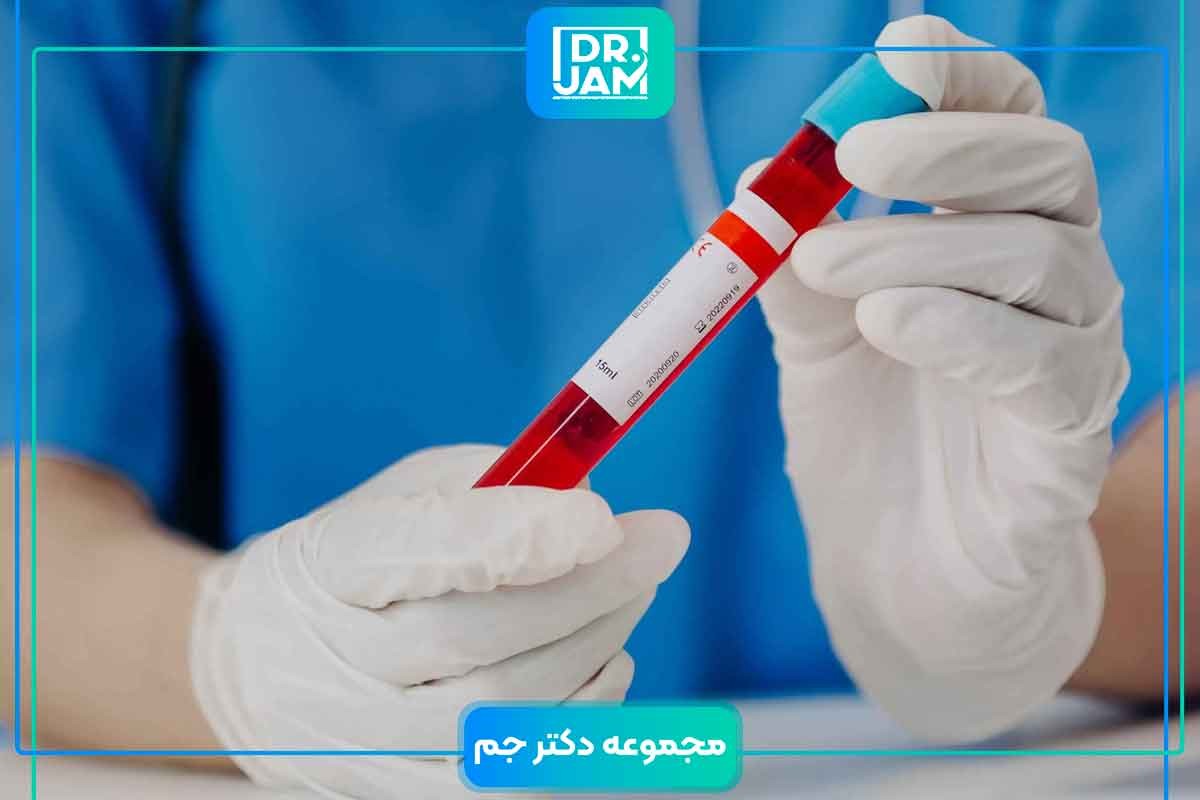 Lipid profile blood test