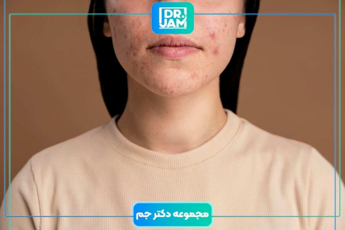 آیا لک صورت برمی‌گردد
