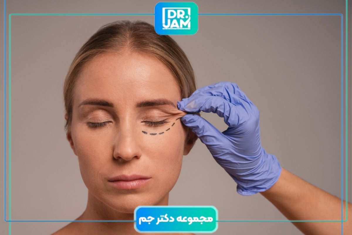 مراقبت بعد از تزریق ژل و بوتاکس