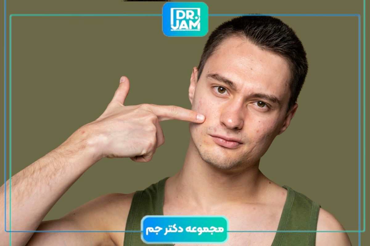 درمان قطعی آکنه در نوجوانان و بزرگسالان