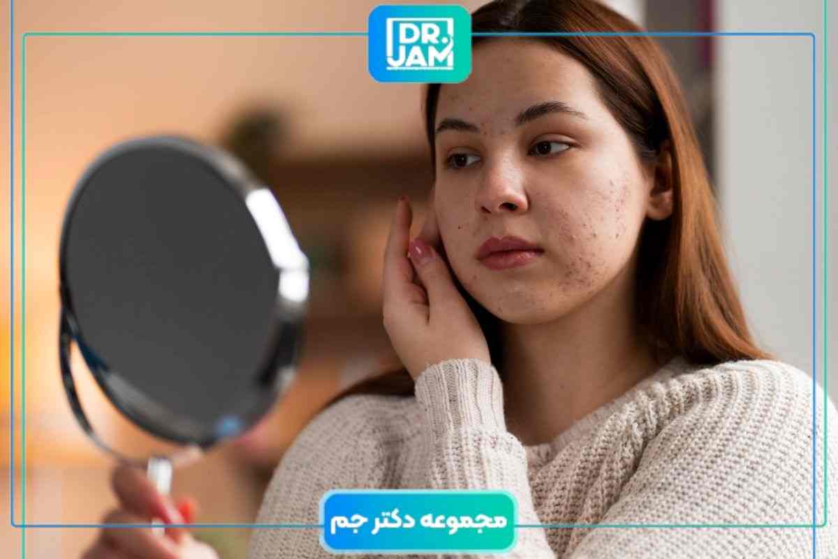 MITF و تیروزیناز چه نقشی در ایجاد لک پوستی دارند؟